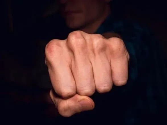 На Львівщині під час "спілкування" з чиновником отримав травми екснацгвардієць