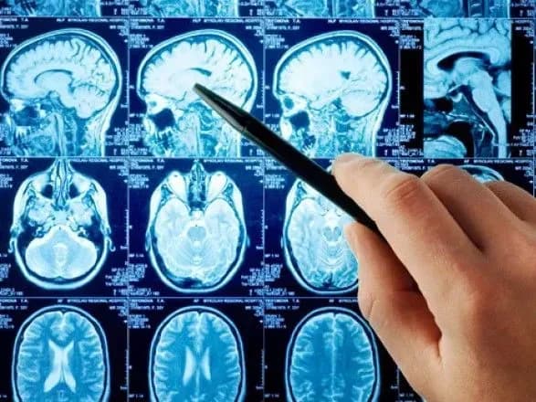 У НЗСУ роз'яснили питання фінансування медзакладів для допомоги при інфаркті та інсульті