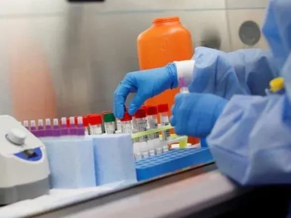 США і деякі країни ЄС створюють систему "імунного паспорта" на основі ІФА-тестування