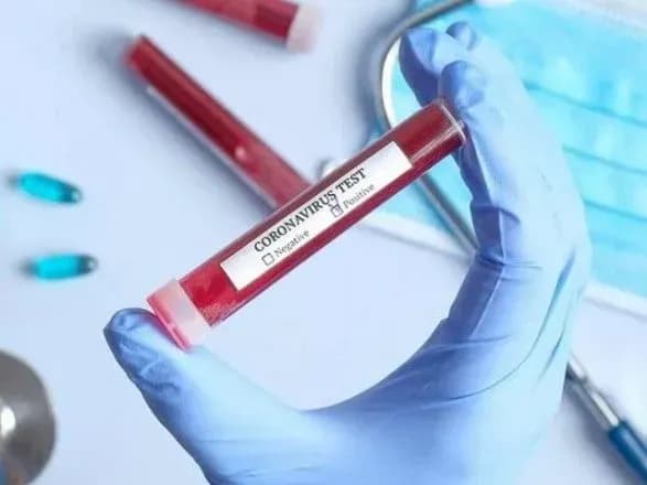 На Сумщині понад 65% медперсоналу протестували на антитіла до covid-19