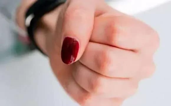 Жінка до смерті побила колишню свекруху на Кіровоградщині