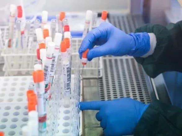 В Україні вже 60 тисяч випадків COVID-19, за добу - 673