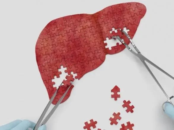 В Україні лише 6,5% людей з гепатитом C знають про свій діагноз - Степанов