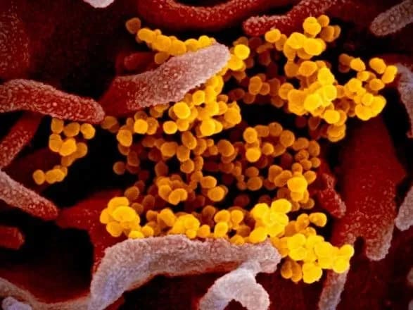 В Україні виявлено вже понад 74,2 тис. випадків COVID-19, за добу - 1061