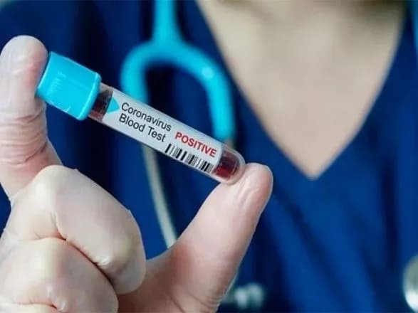 У Києві за добу COVID-19 виявили у 200 осіб, троє померли