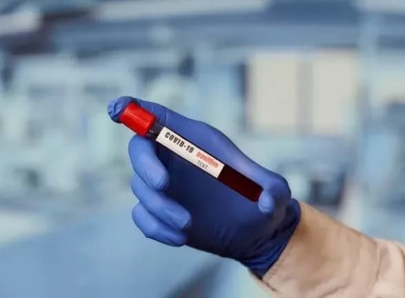 Без ІФА-скринінгу Україна не в змозі спрогнозувати “ковід”-ситуацію - лікар