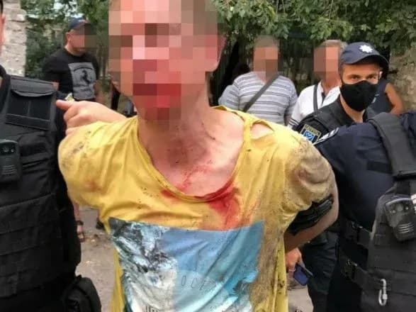 У Дніпрі біля будинку вибухнула граната, двоє людей поранені