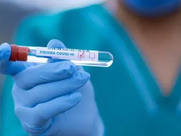 У Києві за добу коронавірусну хворобу виявили у понад 440 осіб, померло 12