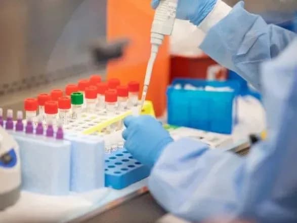 МОЗ планує максимально залучити приватні лабораторії до тестування на COVID-19