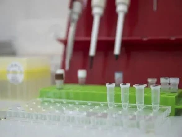 Особи, які контактують з Президентом, проходитимуть регулярний ІФА-скринінг