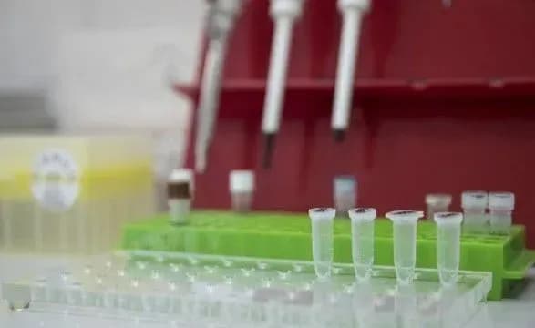Лікар-епідеміолог: кожен четвертий ПЛР-тест може давати хибнонегативний результат