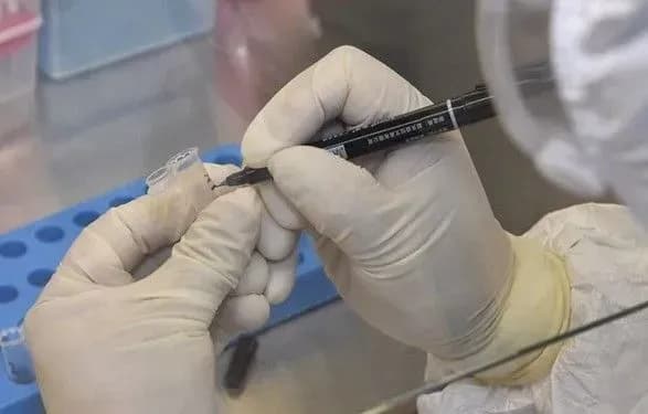 Дослідники повідомили про першу смерть від повторного зараження COVID-19