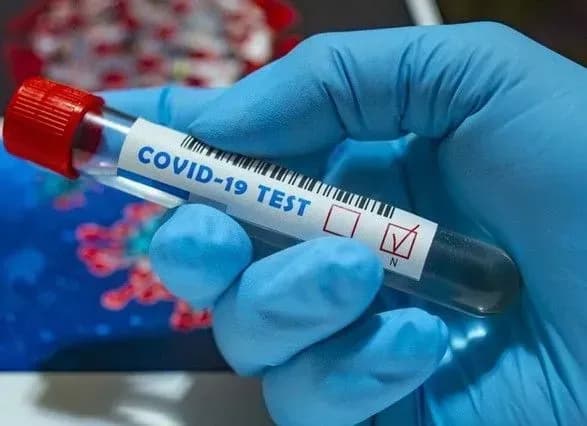 В Киеве за сутки COVID-19 подтвердили у 598 человек, 12 - умерли