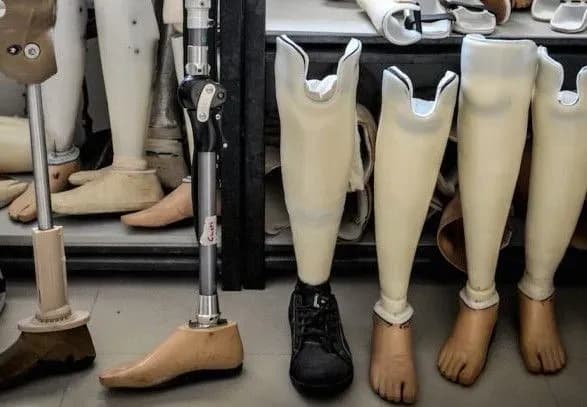 Уряд врегулював питання повторного забезпечення протезами учасників АТО/ООС