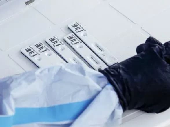 Розробники унікальних тестів на COVID-19 готові долучитись до ініціативи уряду із масового тестування