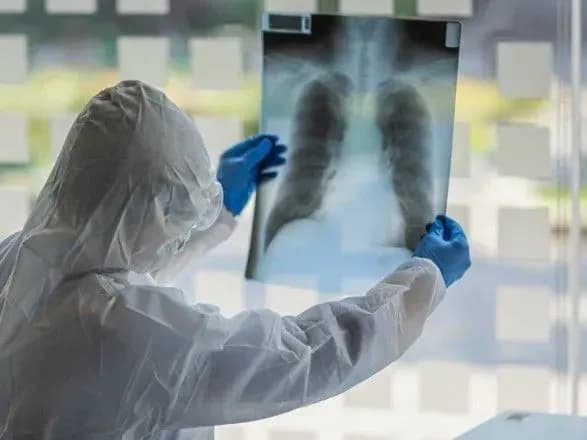 У Миколаєві не виплатили компенсацію через смерть лікаря від COVID-19: у МОЗ з’ясовували причини