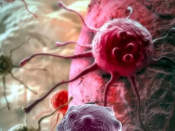 В Україні більше одного мільйона людей мають онкологічні захворювання – Степанов