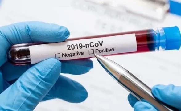 В Україні вже 1,342 млн випадків COVID-19, за добу - 8 172