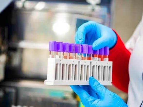 Коронавірусною інфекцією у світі захворіло вже понад 116,4 млн людей