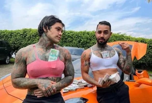 Програв парі: колумбійський блогер встановив собі грудні імпланти