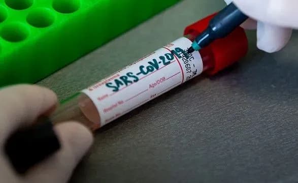 Коронавірусною інфекцією у світі заразилося понад 122,2 млн людей