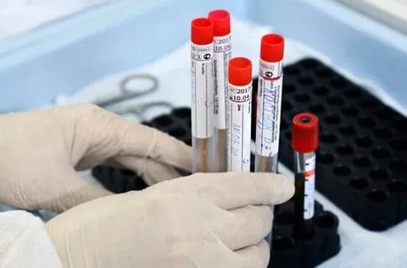 В Україні необхідно звертати увагу на якість тестів на COVID-19 – Держпродспоживслужба Києва