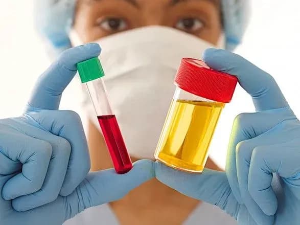 Ефект Юрченко: чи потрібно українських політиків примусово перевіряти на наркотики і проводити психічний огляд