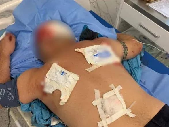 У Черкасах під час конфлікту чоловік влаштував стрілянину: двох людей госпіталізували