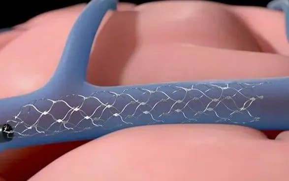 У США дозволили проводити на людях випробування з імплантації комп'ютерних інтерфейсів у мозок