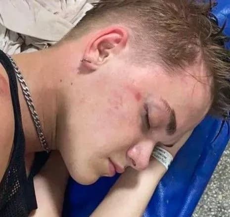 Побиття танцівника балету Дорофєєвої: в УДО заявили, що нападником був їх військовослужбовець