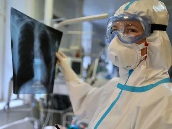 В Україні вже 2,44 млн випадків COVID-19, за добу - 11 809