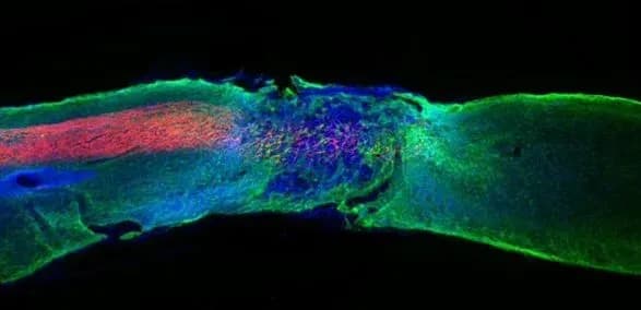 Вчені розробили нову форму ліків, які усувають параліч