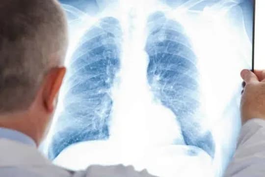 12 листопада — Всесвітній День боротьби з пневмонією