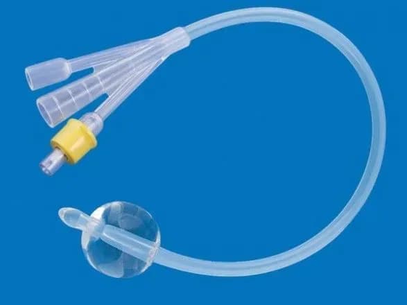 Відчувала дискомфорт: в Івано-Франківську жінка півтора роки жила з катетером у сечовому міхурі