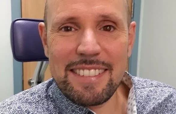 Жителю Лондона імплантують око надруковане на 3D-принтері