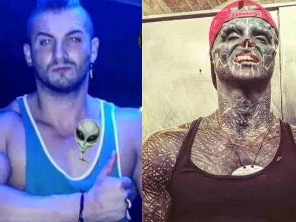 Мріє стати інопланетянином: француз ампутував собі ніс, вуха та пальці, щоб наблизитись до свого ідеалу