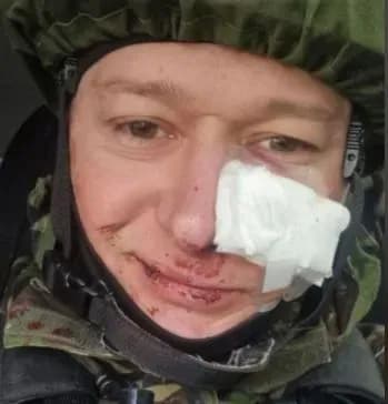 Лідер гурту «Бумбокс» отримав поранення через мінометний обстріл