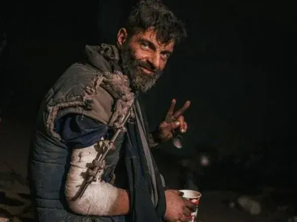 Ціна полону захисника Маріуполя Михайла Діанова: у руці не вистачає 4 см кістки