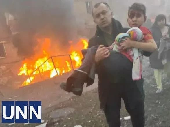 Донька ледь не втратила око: постраждала під час обстрілу Вишгорода розповіла про стан дітей та чоловіка