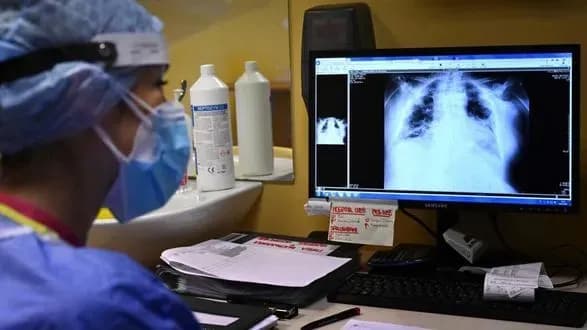 Зростання кількості випадків туберкульозу буде в післявоєнні часи - МОЗ