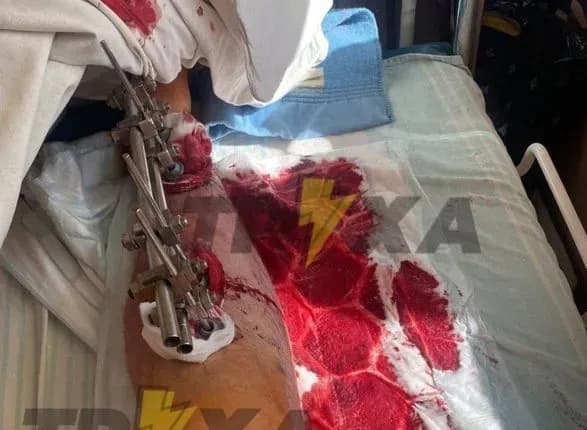 У Києві п'яний водій збив військового Нацгвардії, чоловіка затримали