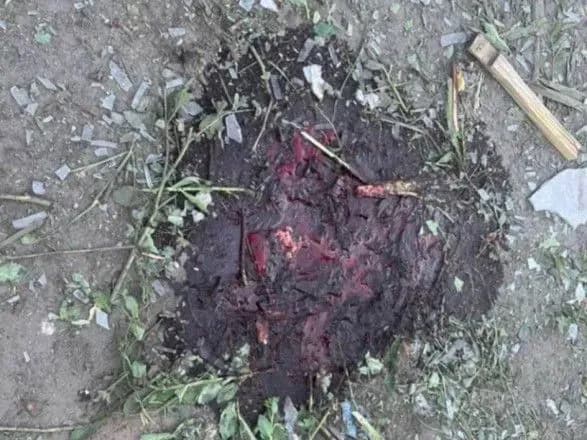 Загинули поліцейській та його маленький син – стали відомі нові подробиці сьогоднішнього обстрілу Сумщини