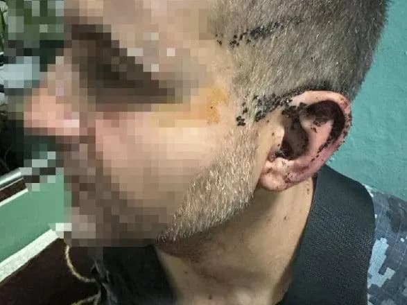 У військовій частині на Одещині побили службовця: відкрито кримінальне провадження