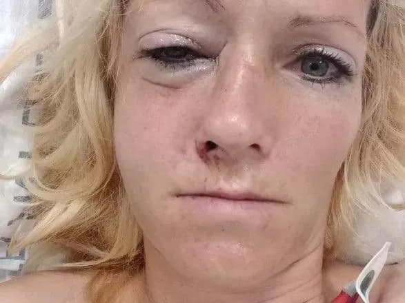 Чоловіка, який побив українок у Чехії, взяли під варту