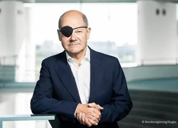 "Не можу дочекатися, щоб побачити меми" - Шольц показав своє фото після травми з пов'язкою на оці