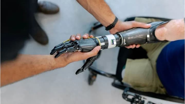 За два останні роки протези в Україні отримали близько 20 тисяч людей, серед яких військові та цивільні - Жолнович