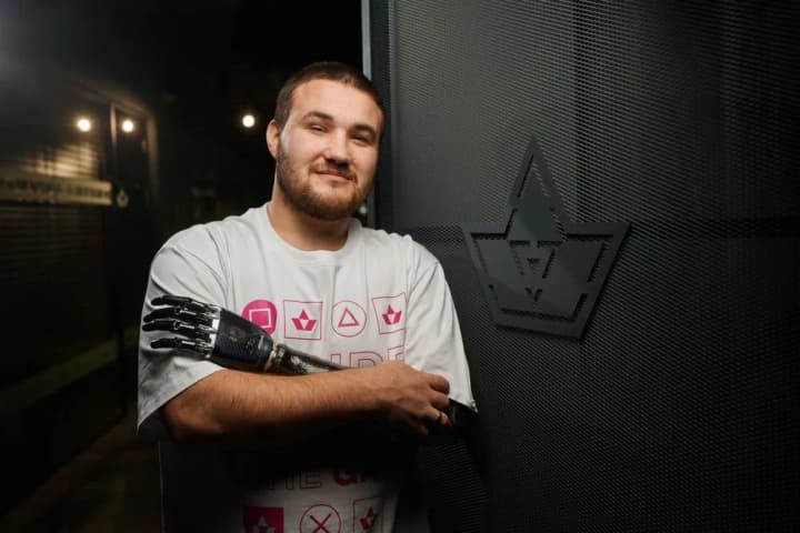 Акция "Киберпанк 2023" FAVBET помогла защитнику Бахмута получить современный бионический протез