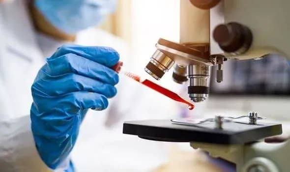 Швейцарські дослідники виявили закономірність в крові хворих на Long Covid: відкриття може зробити революцію в діагностиці та лікуванні