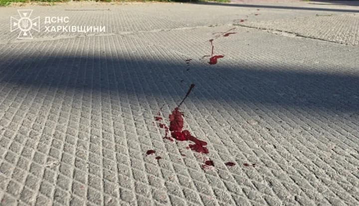 UN: 129 civilians killed, nearly 600 wounded in April as a result of Russian attacks in Ukraine