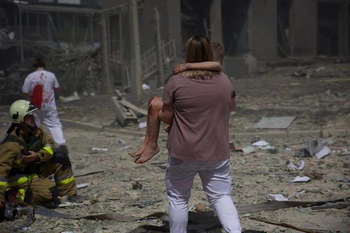 Hospitals in Kyiv region accept patients from Okhmatdyt and other victims of Russian attack - head of RMA